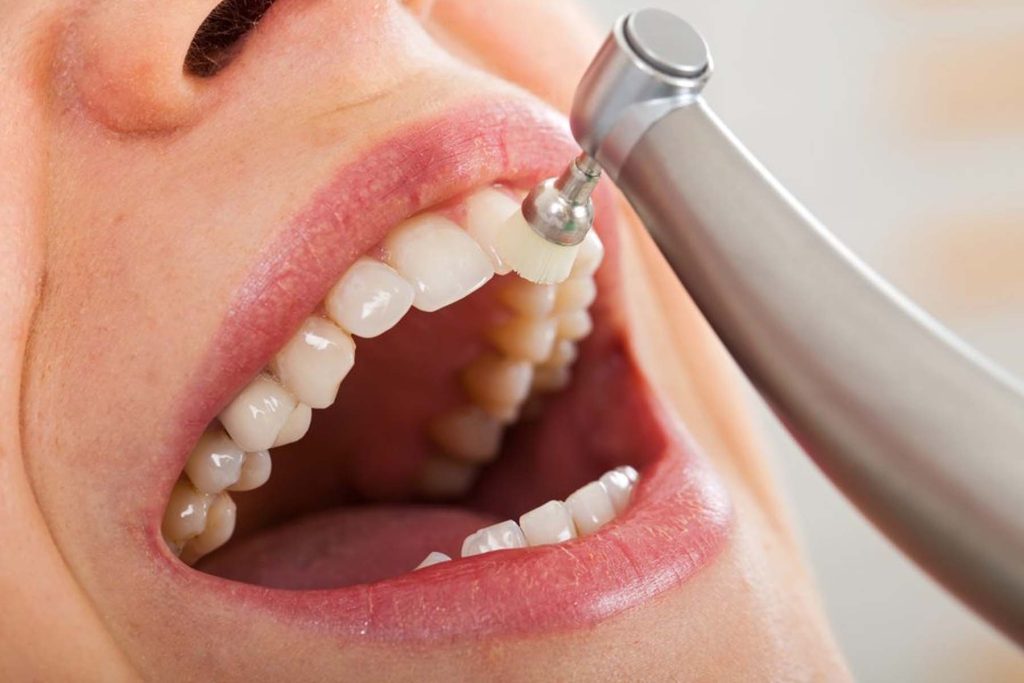 dental cleaning near you