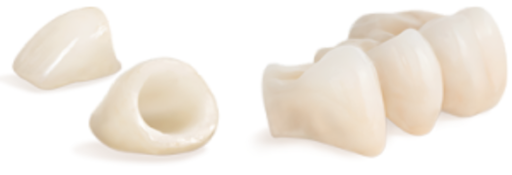 dental crowns in victoria