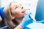 dental air polishing
