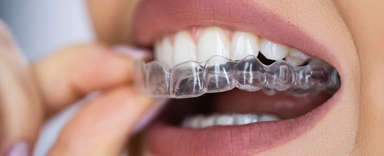 orthodontics near you