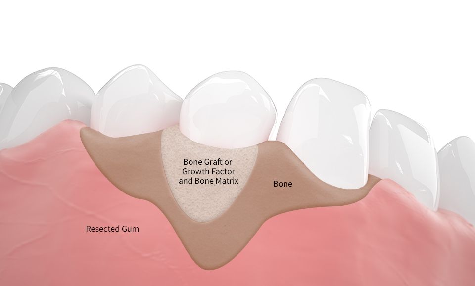 periodontal care near you
