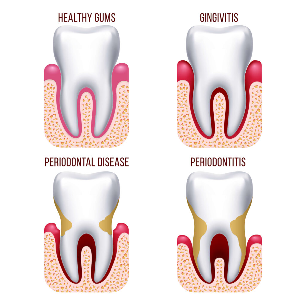 periodontal care victoria